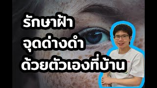 วิธีรักษา ฝ้า ด้วยตัวเองที่บ้านง่ายๆ | 10นาทีกับหมอต่อ