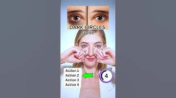 Dark circles Gone | Face Fitness, Facial Fitness, Facial Yoga