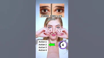Dark Circles Gone Face Fitness Facial Fitness Facial Yoga 