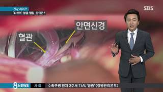 심하게 떨리는 눈꺼풀…'뇌 신경 이상일 수도'/SBS