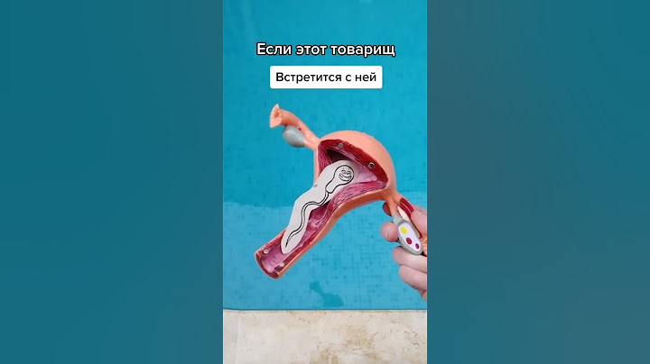 А у вас бывали такие вопросы?) #бассейн #женщины #беременность