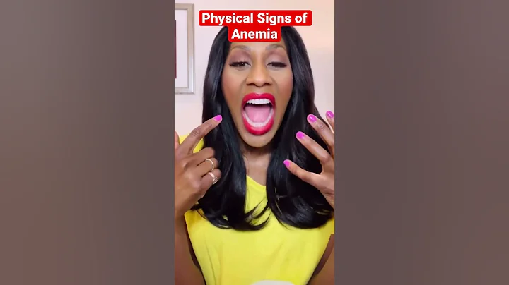 Physical Signs of Anemia🩸! A Doctor Explains #shorts