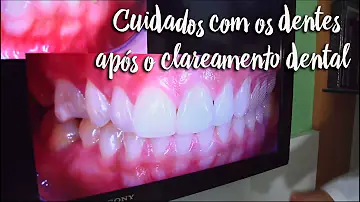 O que mancha clareamento?