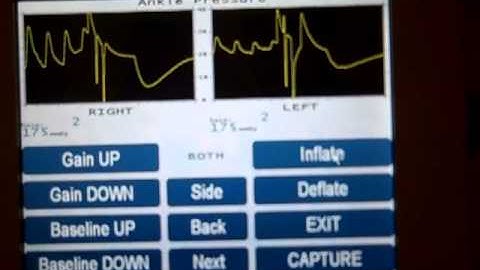 Unetixs MultiLab 2CP Pressures using PPG Sensors