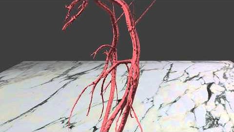 Whole aorta, 3D rendering