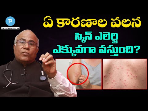 ఏ కారణాల వలన స్కిన్ ఎలెర్జి ఎక్కువగా వస్తుంది? Skin Allergy by | Itching | Telugu Popular TV