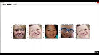 Face Disease CNN Train Streamlit App in Python Projects