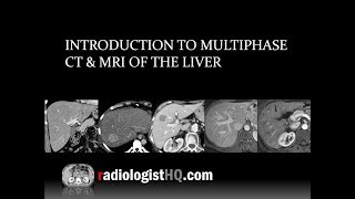 Introduction to Multiphase CT & MRI of the Liver