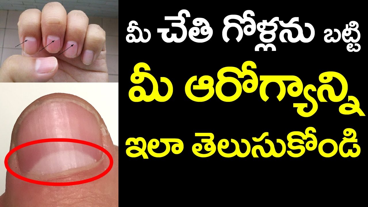 नखं खाण्याची सवय अशी पडू शकते महागात, वाढू शकतो या गंभीर आजारांचा धोका -  Marathi News | Health Tips : Risks nail biting and how stop biting your  nails | Latest health