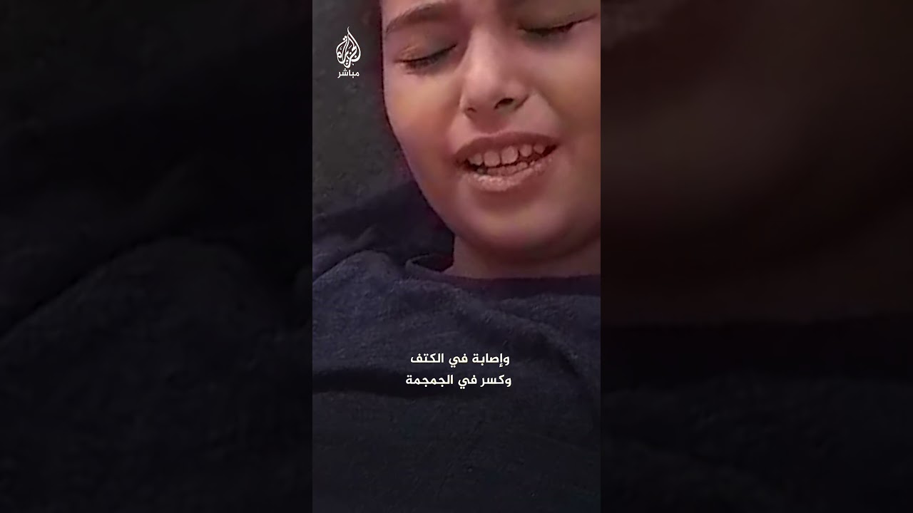 طفلة فلسطينية أصيبت بقصف إسرائيلي تنشد تلقي العلاج في الخارج