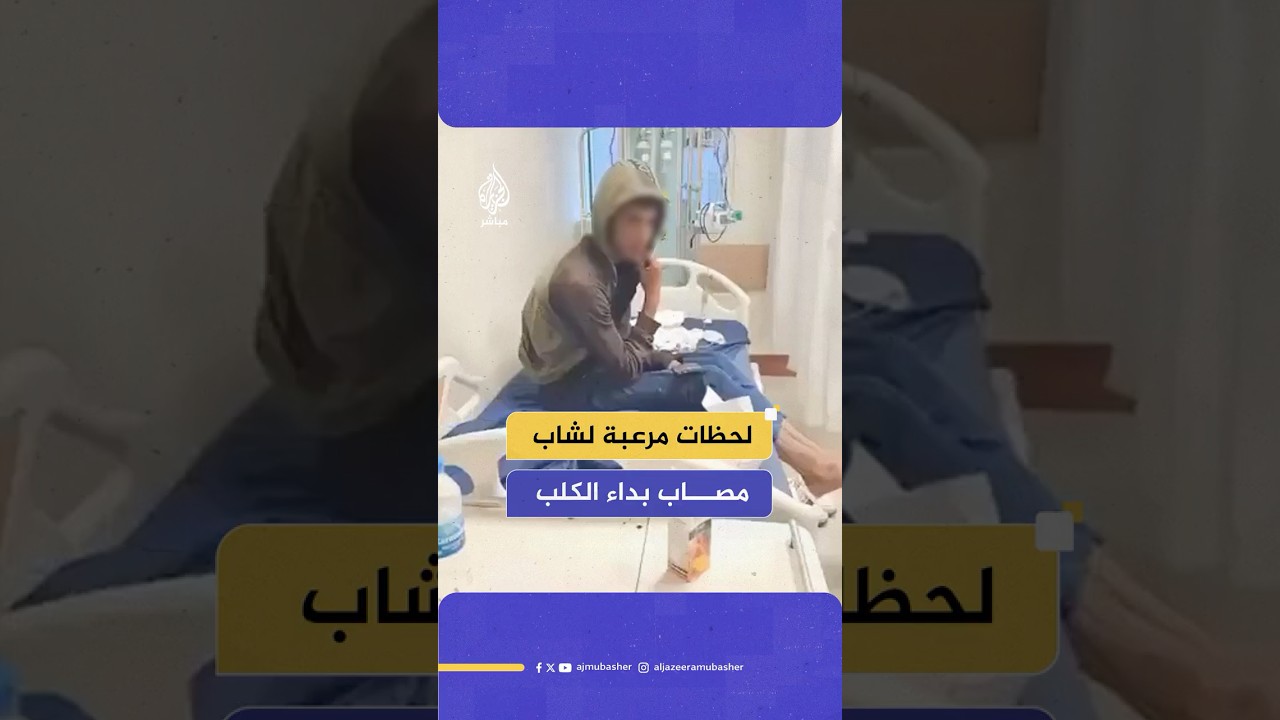 كاميرا هاتف توثق لحظات مرعبة قبل ساعات من وفاة شاب مصاب بداء الكلب في تركيا