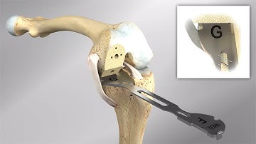 Persona Partial Knee Animation