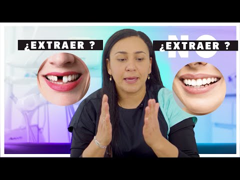 😩 Extraer un