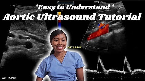 Hoe u een aorta-echografie uitvoert