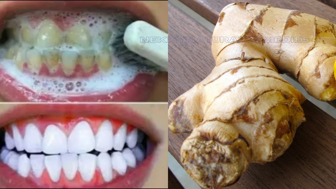Teeth whitening in just a minute - removes yellowing and accumulated ...