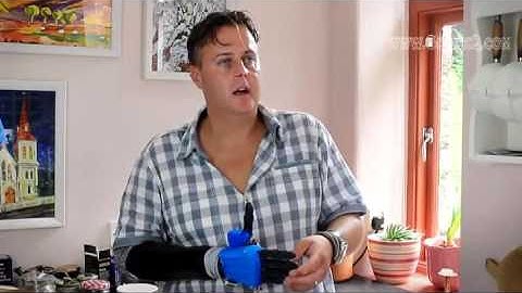 Open Source 3D Printed Prosthetic Project