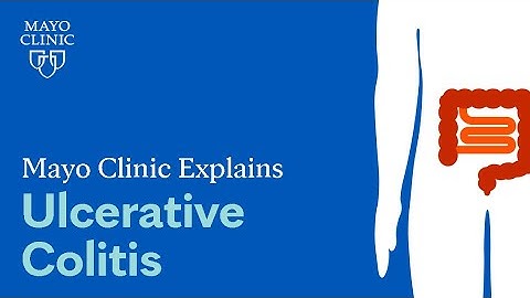 Mayo Clinic Explains Ulcerative Colitis