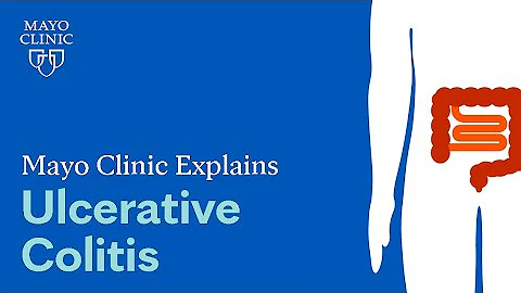 Mayo Clinic Explains Ulcerative Colitis