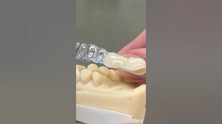 Essix Appliance @EnvisiontecMain #envisiontec #dental #teeth #smile #lsk121shorts #shorts