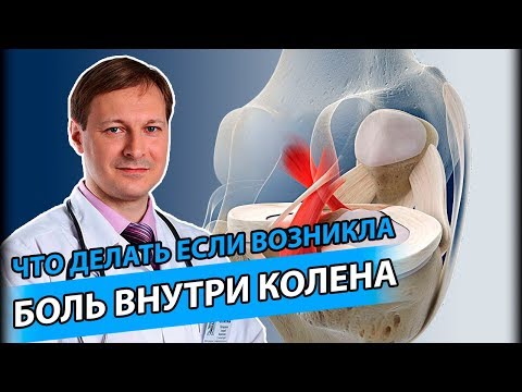 КРЕСТООБРАЗНЫЕ СВЯЗКИ | Как распознать и лечить повреждения