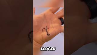 What should you do, If the Fishing hook gets stuck in your hand 😱😱 #ytshorts #shorts #fishing