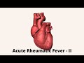 Acute rheumatic Fever - II