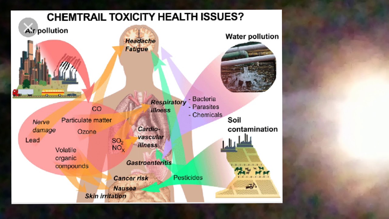 Pollution system. Effects of Air pollution. Diseases caused by Air pollution. Effects of Water pollution. Air pollution Health.