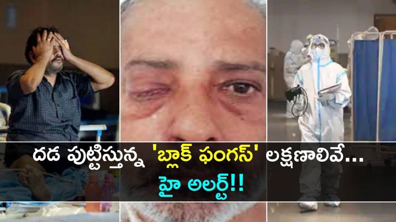 Black Fungus Symptoms స ట ర య డ స ఇవ వడ వల ల బ ల క ఫ గస లక షణ ల వ Oneindia Telugu Youtube