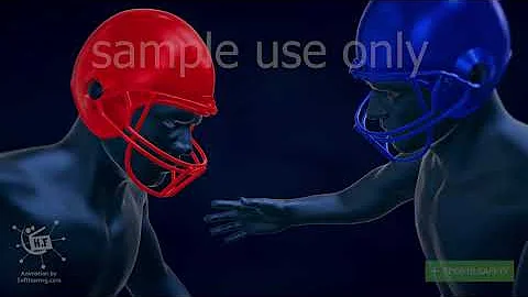 Concussion 3d medical animation | Traumatic Brain Injury | dandelion team