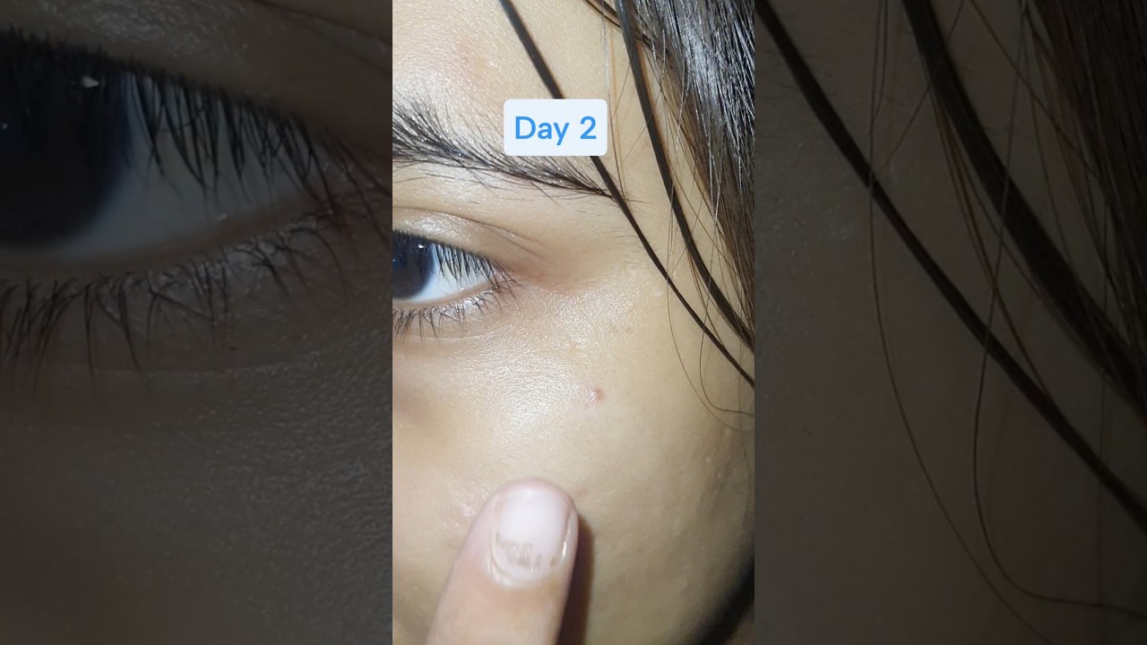 Aegte Hydra Glow Skin Renewal Magic Gel 7 Days Challenge Day 2 