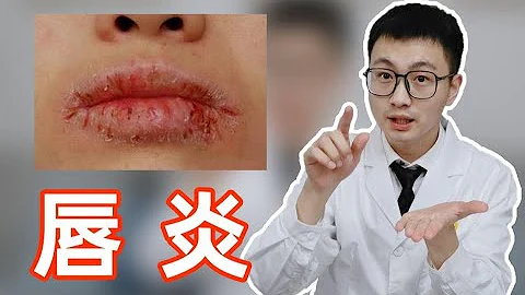 嘴唇乾裂、腫脹，唇炎真的很難受！皮膚科醫生手把手教你擺脫唇炎的困擾 - 天天要聞