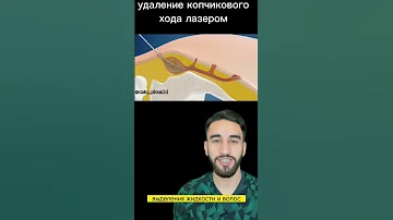 копчиковый ход