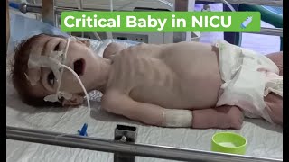 Critical Baby in NICU 💉 | 15ml NG Feeding Trial & 50% Improvement | Hyponatremia Case Recovery 👶