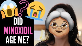 DOES MINOXIDIL + ROGAINE CAUSE AGING My Story + Doctors Thoughts On WRINKLES, BAGS, COLLAGEN LOSS