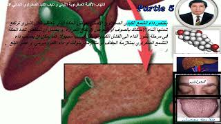 التهاب الأقنية الصفراوية الأولي و تليف الكبد الصفراوي البدائي الجزء   الخامس