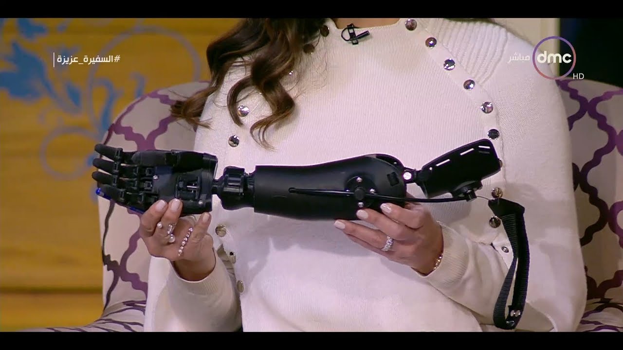 السفيرة عزيزة - مصر الخير تقدم أطراف صناعية بصناعة مصرية ومجانية !!