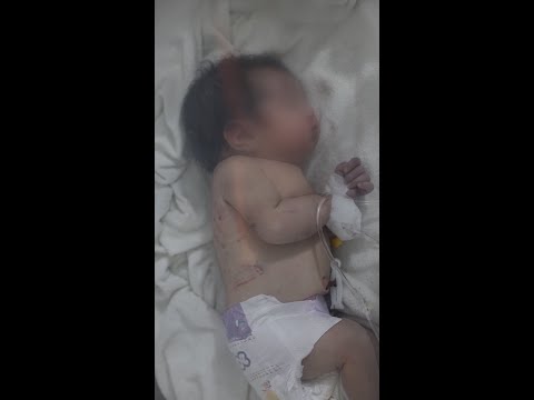 Baby rescued from earthquake rubble in Syria - DW News.