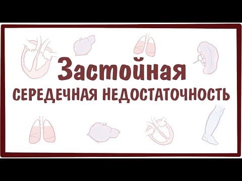 Видео: Застойная сердечная недостаточность: продолжительность жизни и прогноз по стадии