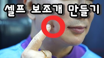 [닥터박] 본인 얼굴에 셀프로 보조개 수술을 하는 의사 셀프의료성형