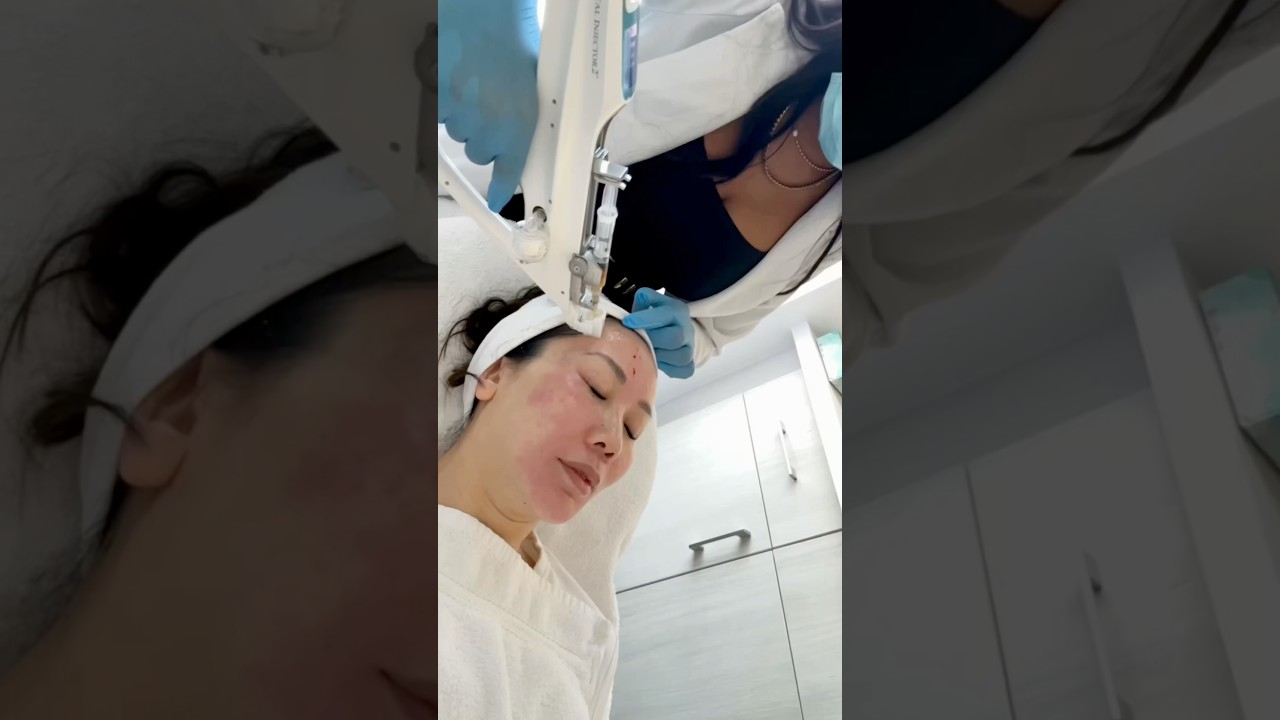 PRP treatment vlog part 1 