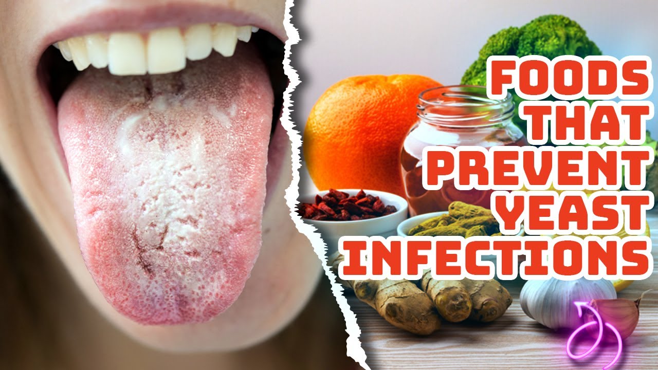 Prevent Yeast Infections