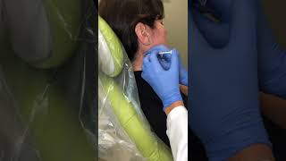 Injecting Peptides, to help with TMJ pain after surgeries.