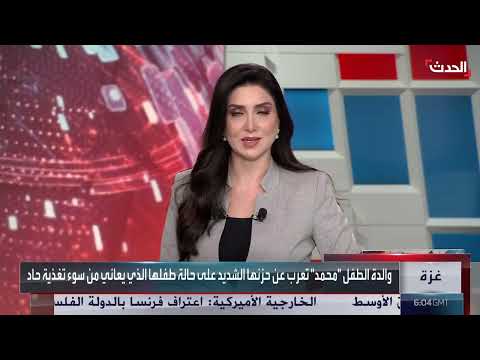 اليمن: طفل يعاني سوء التغذية الحاد وأم تناشد المساعدة