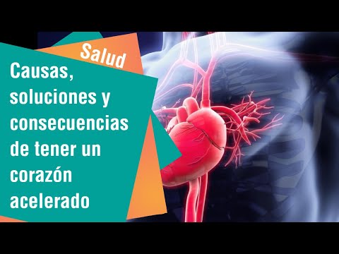 Video: ¿Puedes decir acelerado?