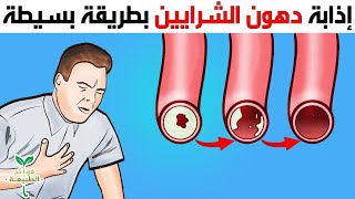 علاج تصلب الشرايين و القلب و الوقاية منه بطريقة بسيطة غير مكلفة / بدون ادوية