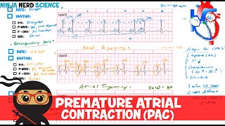 Rate and Rhythm | Premature Atrial Contraction (PAC)