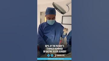 Gastric Sleeve Surgery