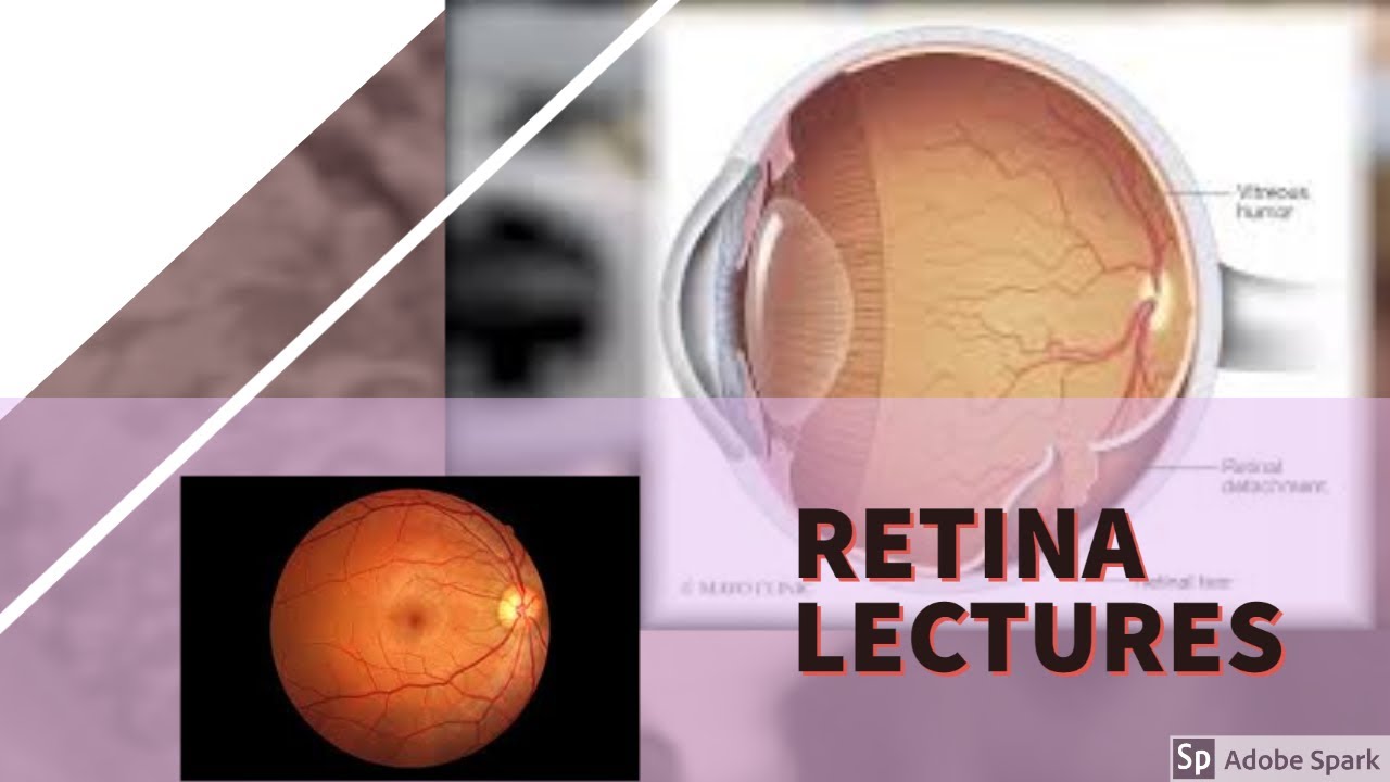 RETINA LECTURE 7 DIABETIC RETINOPATHY in detail with all important stuff