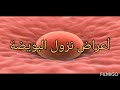 ماهي أعراض نزول البويضة الأكيدة؟؟