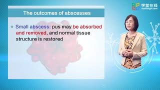 22 Suppurative purulent Inflammation